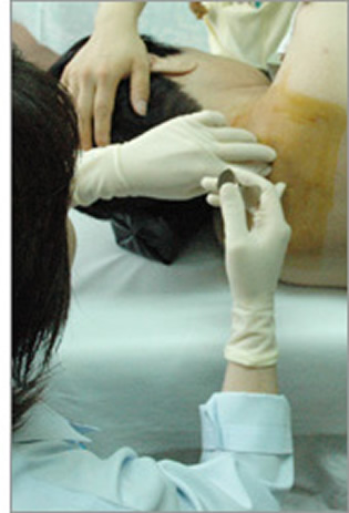 脊椎注射.jpg